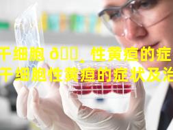干细胞 🌸 性黄疸的症 ☘ 状（干细胞性黄疸的症状及治疗）